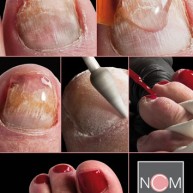 NCM SculptureGel Saschas Pedicurepraktijk